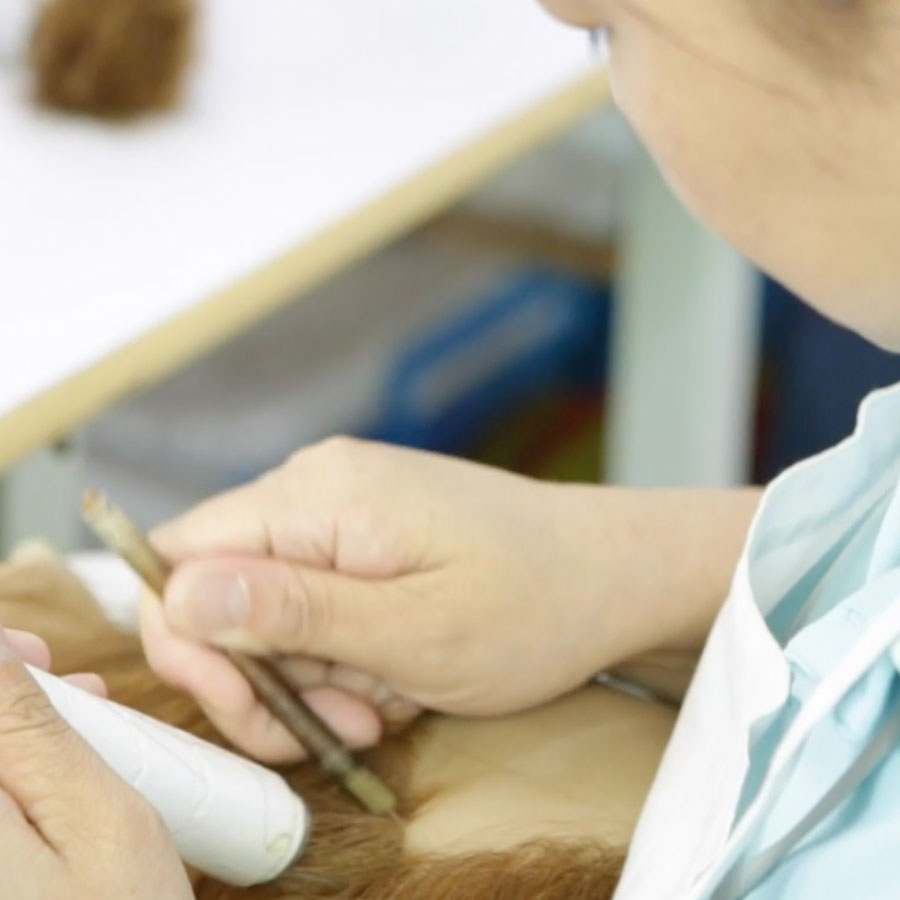 Hair-Implantation